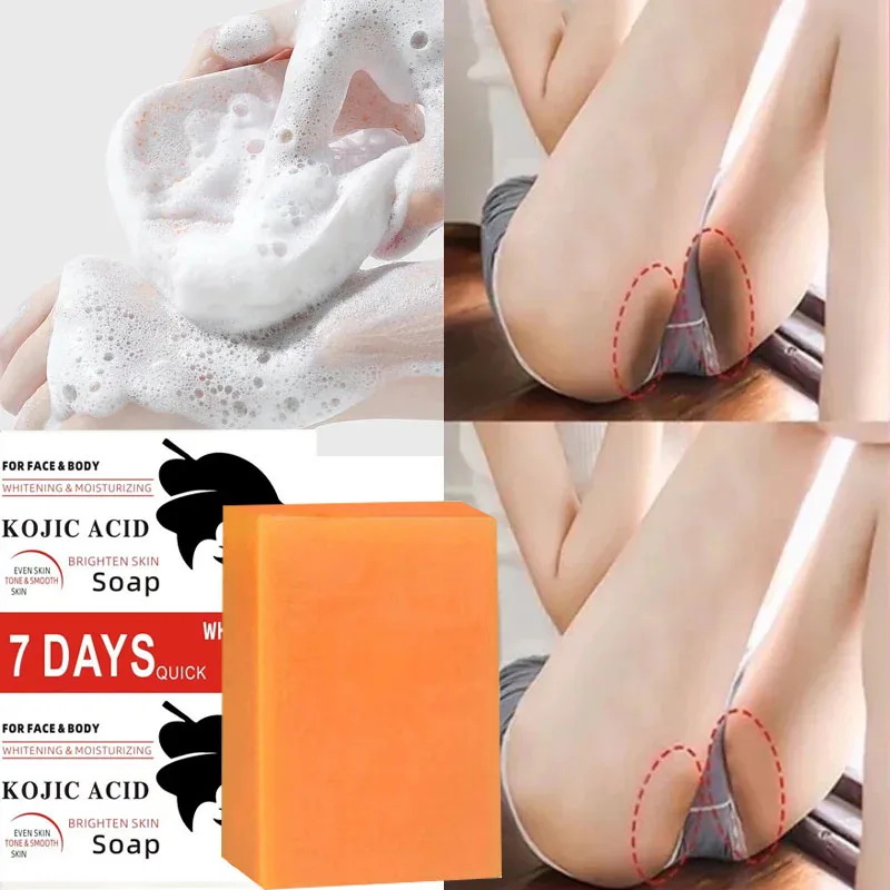 Kojic Acid Soap - 코직산 바디 화이트닝 비누 딥 스킨