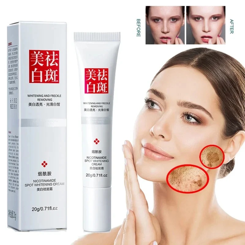 페이드 및 주근깨 개선 블랙 스팟 페이스 크림 화이트닝 - Skincare Glow 리뷰 및 가격