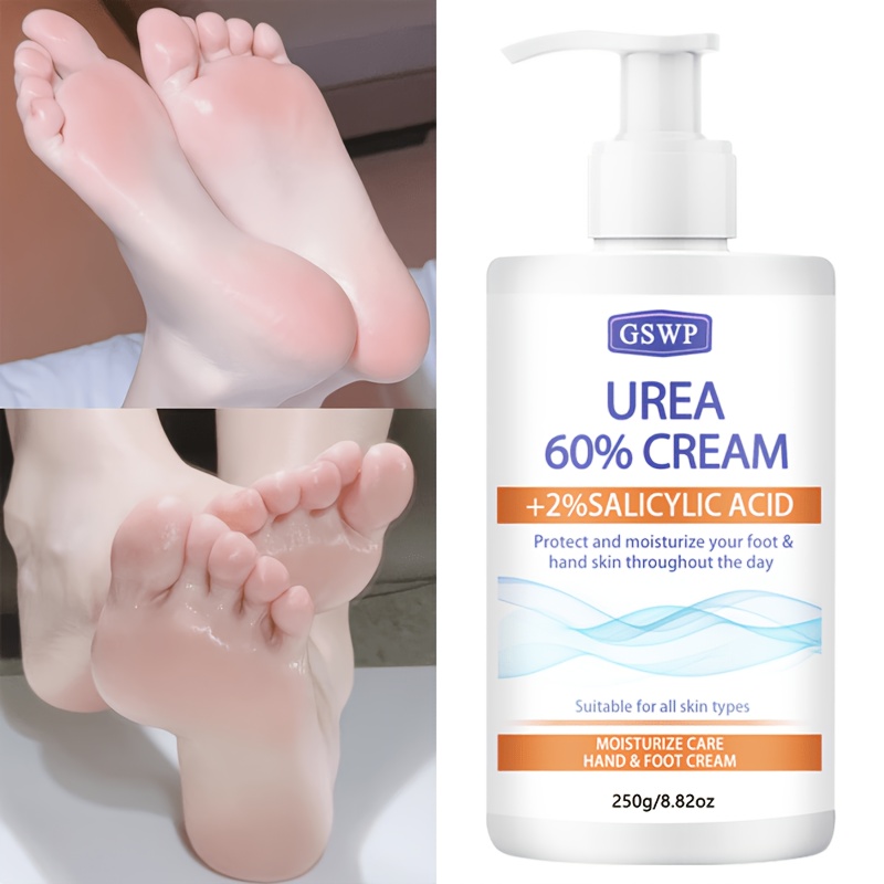 GSWP 60% 우레아 보습 핸드 앤 풋 크림, 살리실 - Azelaic Acid Cream 리뷰 및 가격