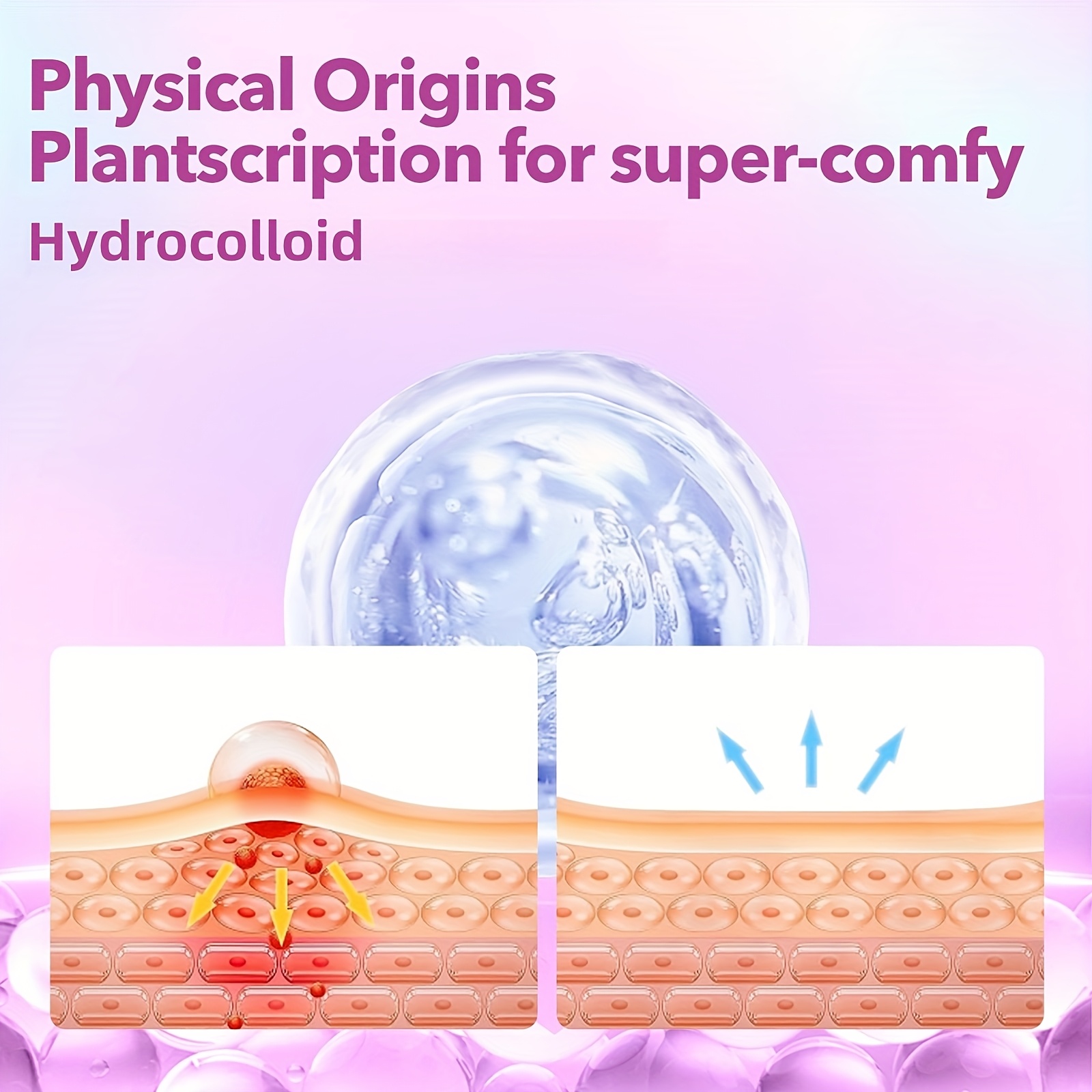 432개/박스 여드름 패치, 자극 없는 여드름 스티커, - Azelaic Acid Cream 리뷰 및 가격