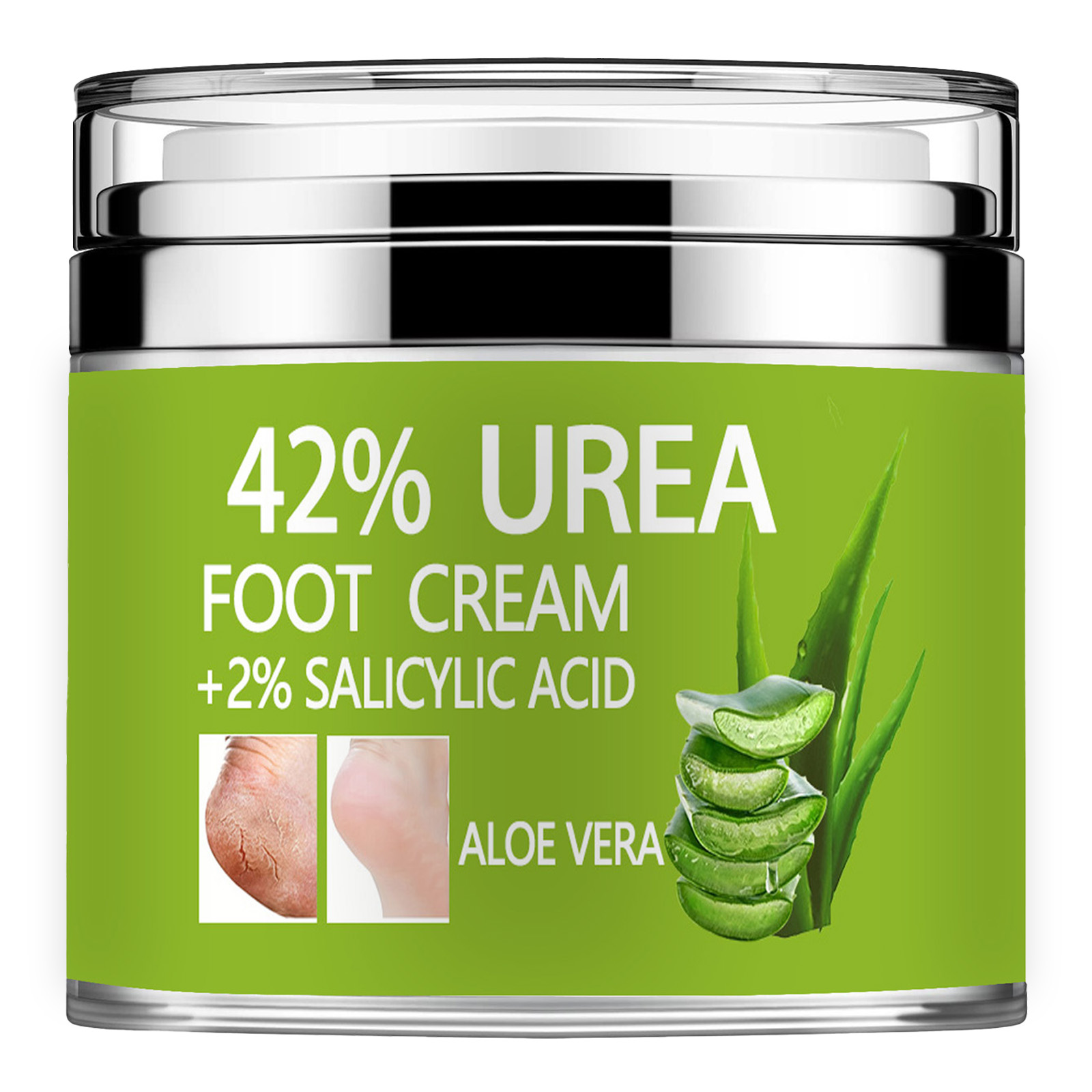 우레아 크림 42% 플러스 살리실산 2%, 건조하고 갈 - Azelaic Acid Cream 리뷰 및 가격